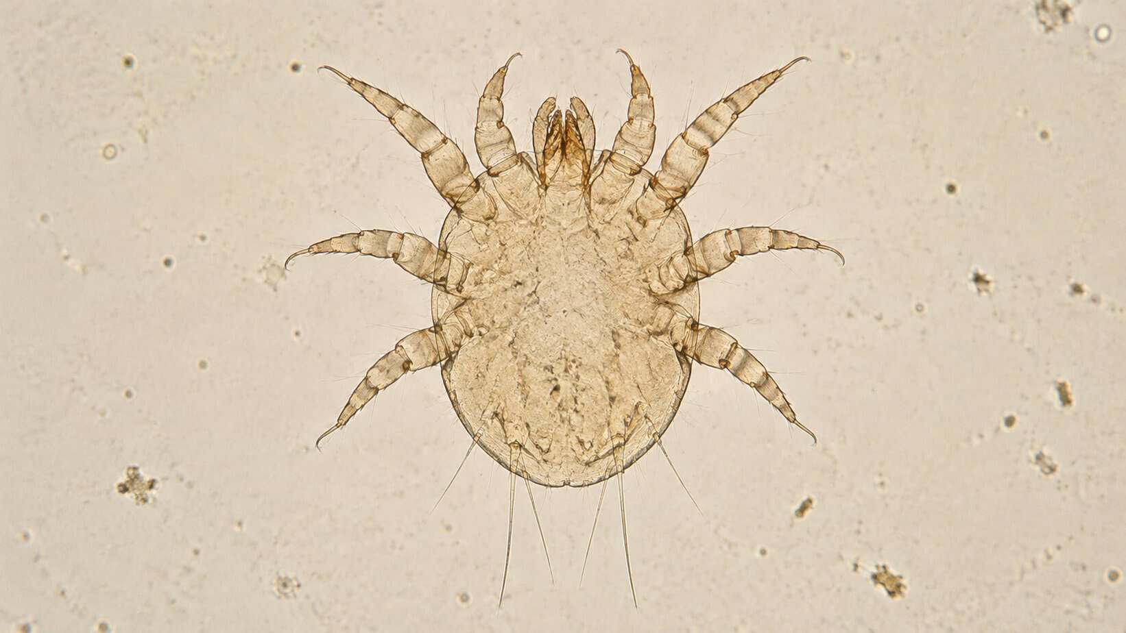 Ear mite viewed under a light microscope