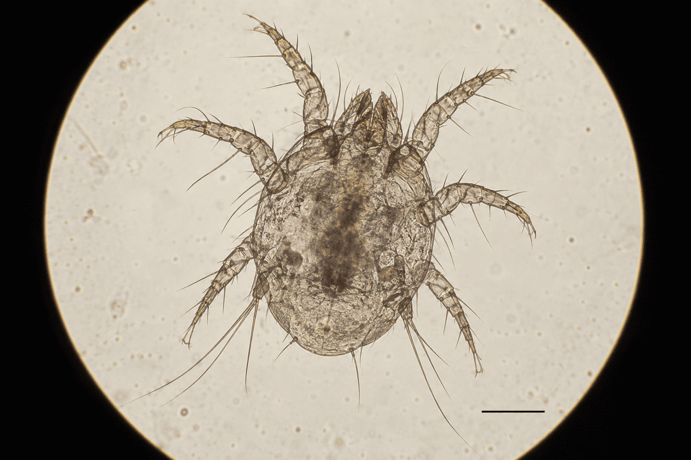 Adult ear mite under a microscope
