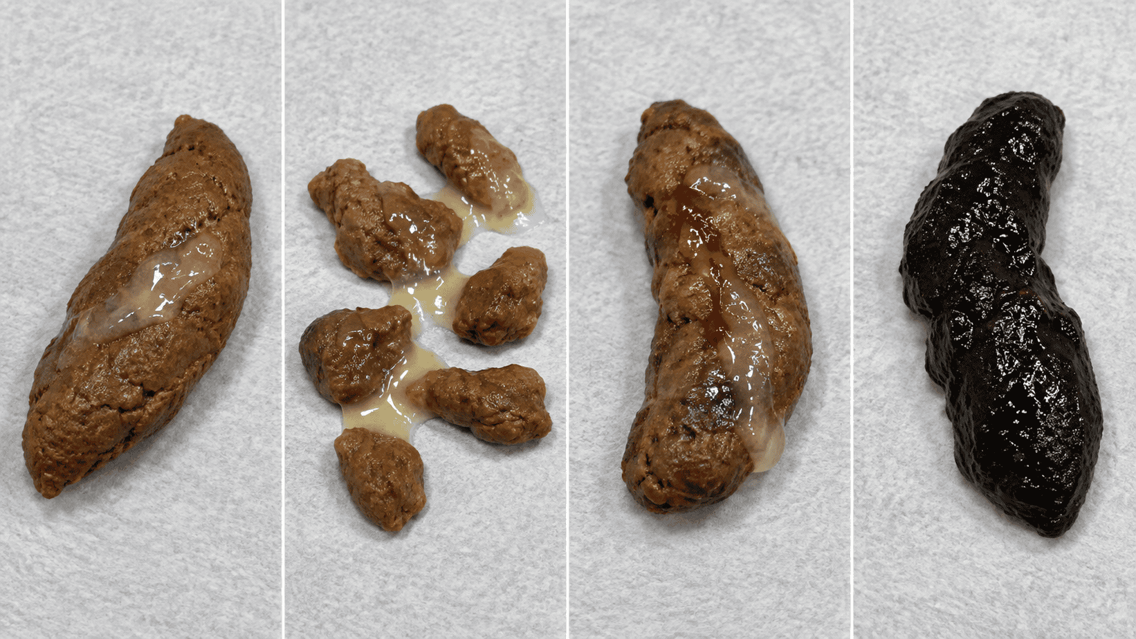 Four-panel comparison of dog stool with mucus, small frequent mucus-coated stool, mucus with fresh blood, and black tarry stool